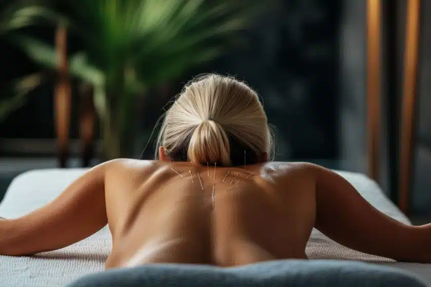 Acupuncture pour maigrir